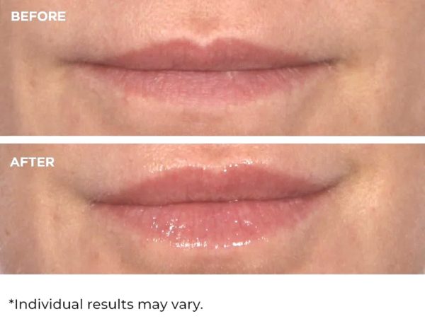 NASSIFMD - Hydro-Screen Lip Plumper - Pink Champagne (4ml)