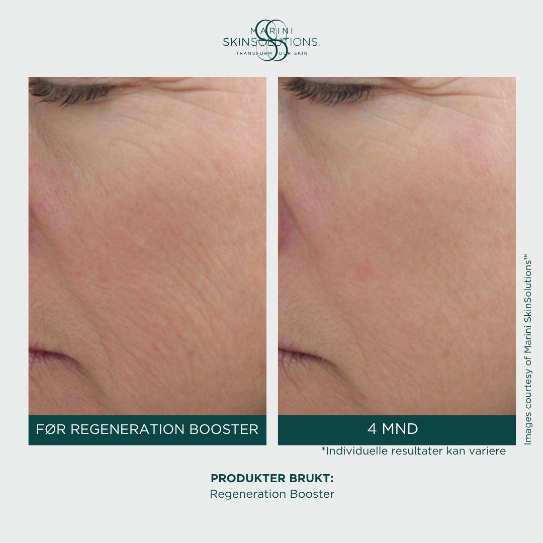 Jan Marini - Regeneration Booster Face Lotion (30ml)